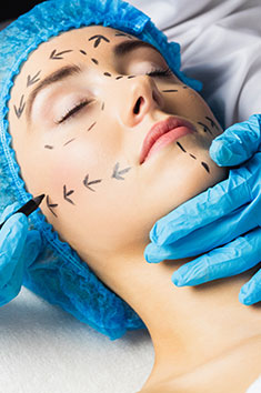 Facial Lifting