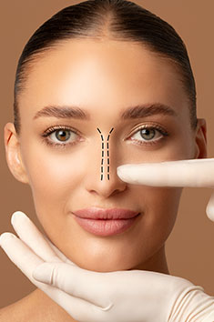 Rhinoplasty